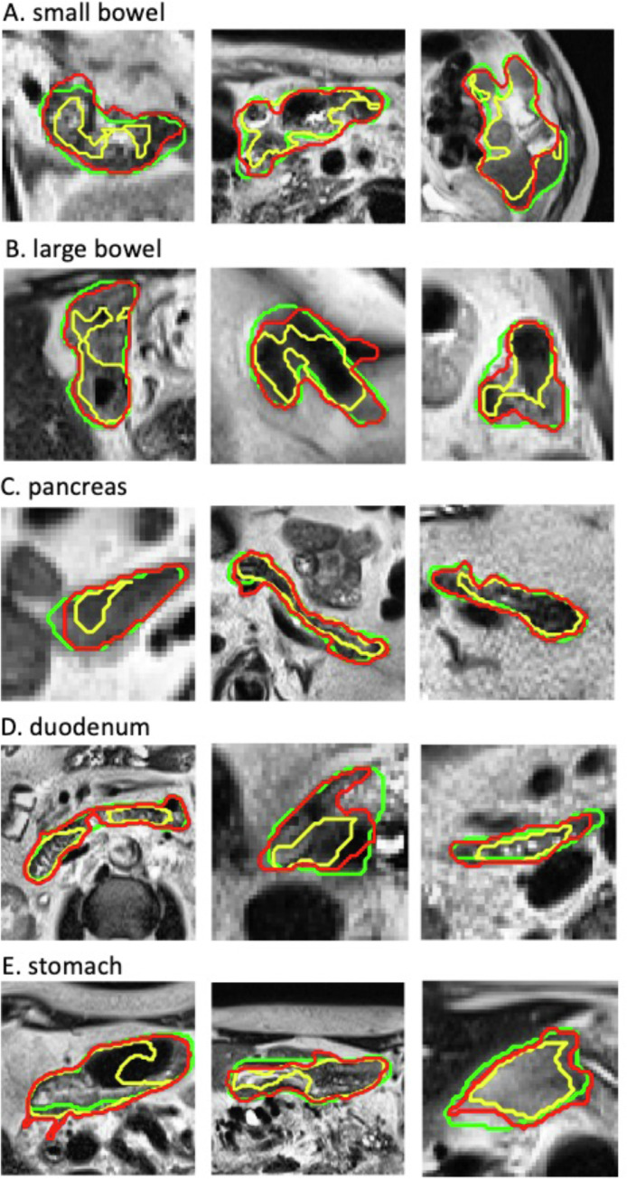 Fig 3