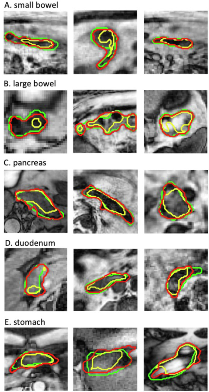 Fig 4