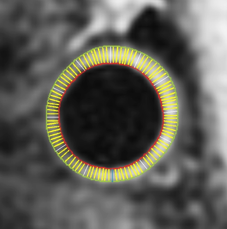 Figure 1f: