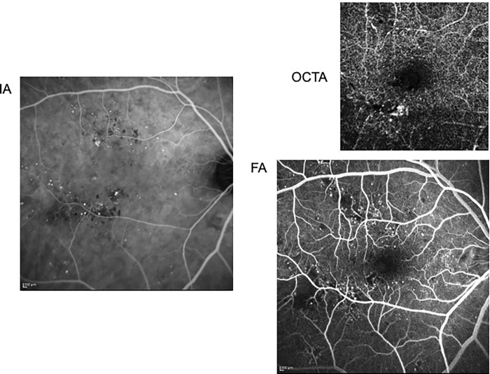 Fig 5