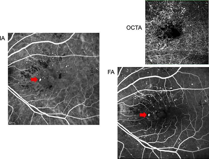 Fig 4