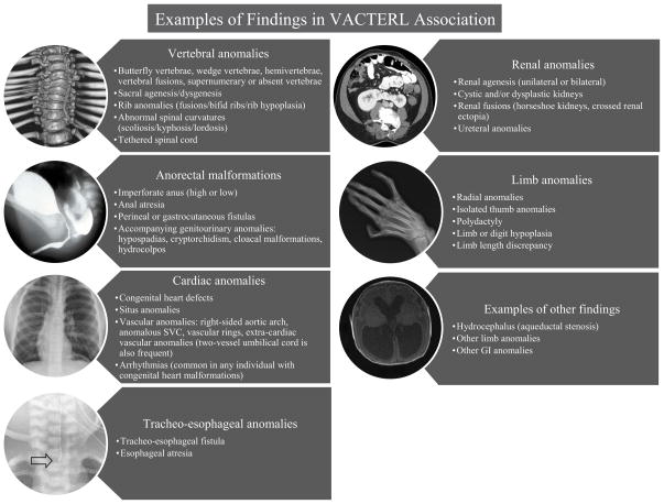 An approach to the identification of anomalies and etiologies in ...