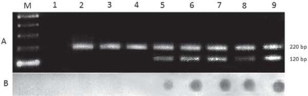 Products from polymerase chain reaction (PCR) multiplex assays
submitted to hybridisation analysis for the diagnosis of naturally
Leishmania (Viannia) braziliensis infection in Psychodopygus
complexus and Psychodopygus ayrozai collected in the municipality of
Guaraí, state of Tocantins, Brazil. A: ethidium bromide-stained 2%
agarose gel revealing the 220 bp product form the cacophony gene
amplification and the 120 bp fragment corresponding to the conserved
region of kinetoplast minicircles from Leishmania spp [M: molecular
weight marker (100 bp DNA ladder); Lane 1: amplification reaction
without added DNA (PCR negative control); 2-4: negative controls for
the DNA extraction step (male insect pools): 5-8: female sandfly
pools (5-7: Ps. complexus positive pools; 8: Ps. ayrozai positive
pool); 9: PCR positive control (DNA extracted from a mixture of male
insect pool containing L. (V.) braziliensis promastigotes)]; B: dot
hybridisation using a biotinylated probe specific for parasites from
the Viannia subgenus.