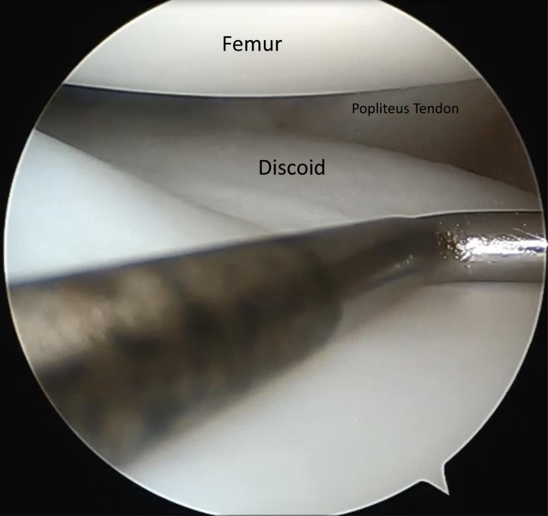 Figure 3