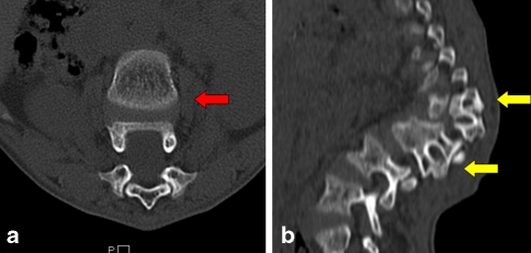 Fig. 3