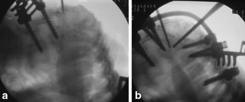 Fig. 4
