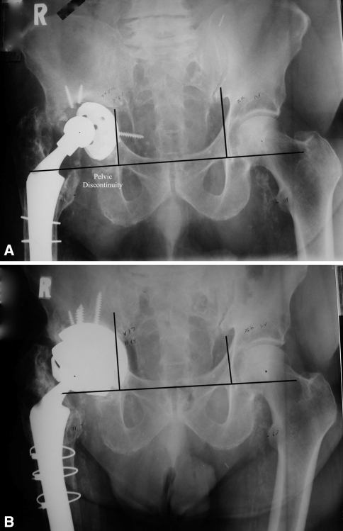 Fig. 1A–B