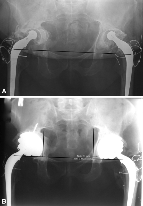 Fig. 3A–B