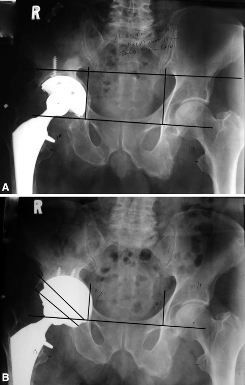 Fig. 2A–B