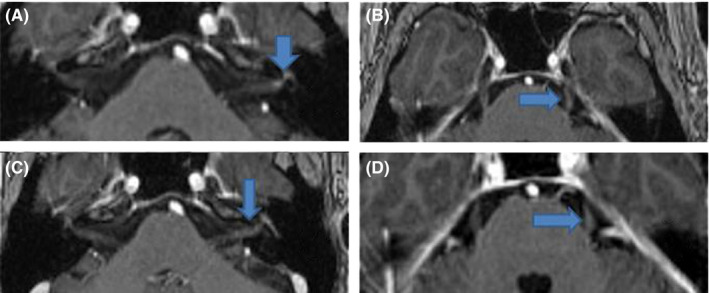 FIGURE 1