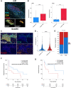 Figure 5. IDO1 expression in TLS correlates with increased Treg levels and poor prognosis. A, Representative illustration of a GeoMx DSP-analyzed TLS. CD4/CD8/CD20 multiplex IF staining (top) and CD20 segmentation masks (bottom) for GeoMx transcriptomics analysis. B, Estimation of the percentage of pDC (left) and Tregs (right) in the CD20 areas of TLS expressing high or low levels of IDO1 by SpatialDecon analysis of GeoMx data. C, Representative image from the CD4/CD8/CD20/Ki67/Foxp3/DAPI multiplex immunofluorescence panel focused on a TLS from an NSCLC adenocarcinoma section. D, Proportion of proliferating Tregs (CD4+/Foxp3+/Ki67+) in TLS according to IDO1 expression. The analyzed TLS (n = 528) were classified as high or low based on the median IDO1 expression level inside TLS. The P value was calculated using a Wilcoxon test. E, Proportion of patients with high and low levels of proliferating Tregs in TLS according to their response to ICI. The P value was calculated using a χ² test. F and G, Kaplan‒Meier curves of the progression-free survival (C) and overall survival of patients classified as high and low according to the levels of proliferating Tregs (CD4+/Foxp3+/Ki67+) in TLS.