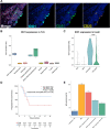 Figure 4. IDO1 is expressed on CD21+/CD23+ FDC within TLS and restricts B-cell activation. A, Representative image from the CD11c/CD14/CD3/CD20/CD21/CD23/IDO1/Mum1/DAPI multiplex immunofluorescence panel focused on a TLS from an NSCLC adenocarcinoma section. B, IDO1 expression in the different cell subsets identified within TLS (n = 6 patients). C, scRNAseq analysis of IDO1 expression in different tonsillar stromal cell subsets (GSE173539). D, Kaplan‒Meier curves of the progression-free survival of TLS+ patients classified as TLS IDO-positive or TLS IDO-negative (positive = at least one TLS with 10% IDO1+ cells). E, Level of IgG secretion by B-cell and Tfh cell cocultures activated with SEB (1 ng/mL) for 7 days or not treated; the doses of kynurenine are indicated (n = 2 different donors).