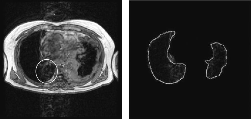 FIG. 7