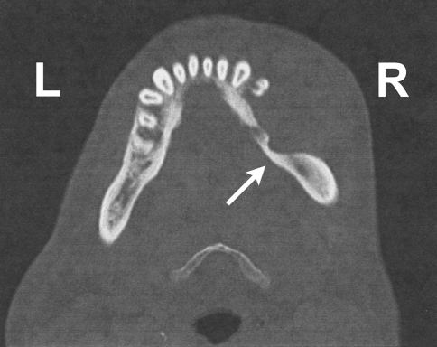 Fig. 1