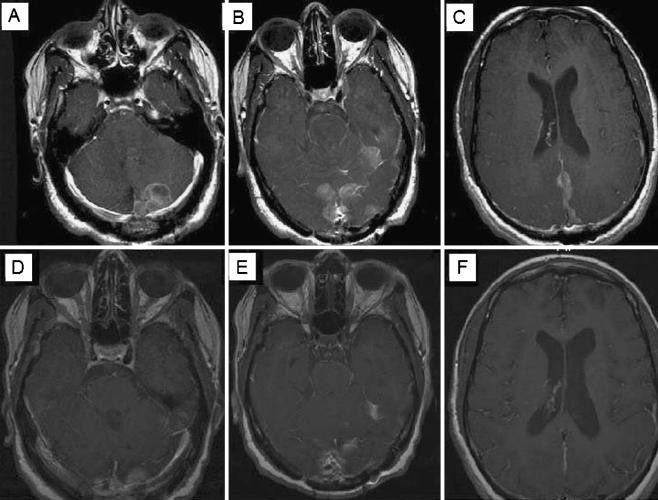 Fig. 6