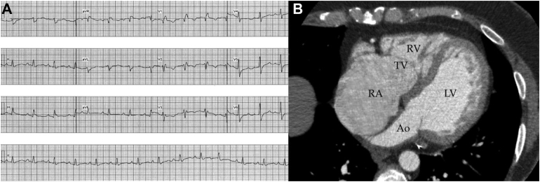 Figure 1