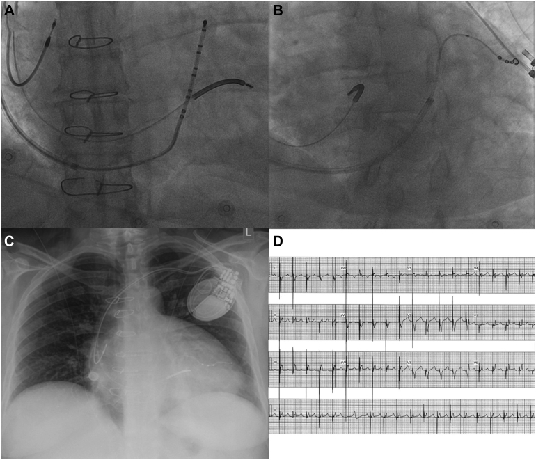 Figure 2