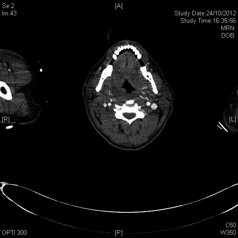 Figure 1