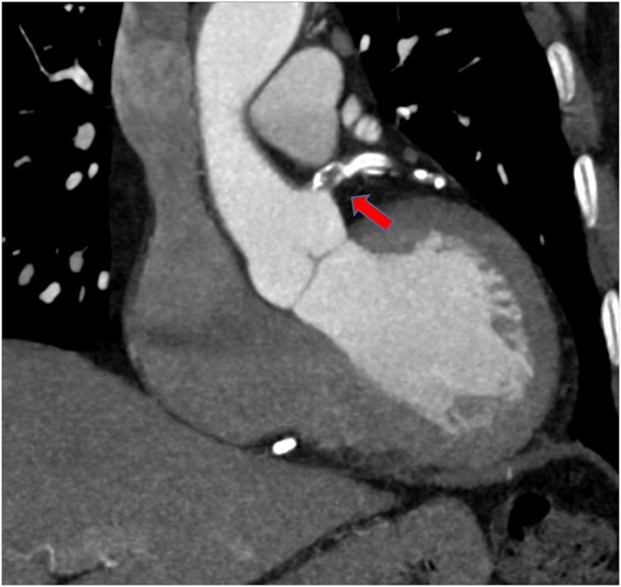 Figure 2