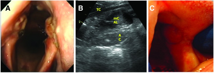 FIG. 4.