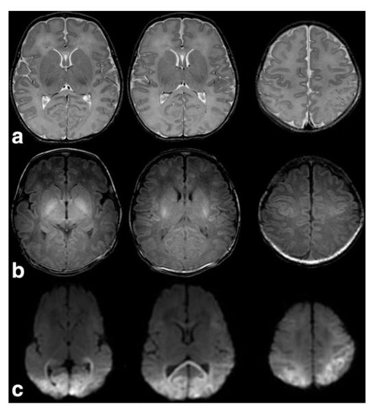 Figure 19