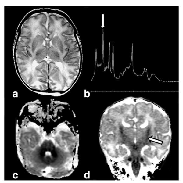 Figure 17