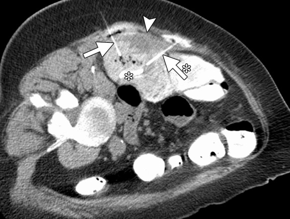 Figure 19b