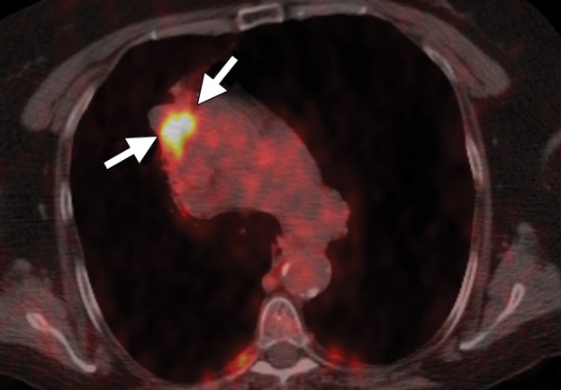 Figure 13a