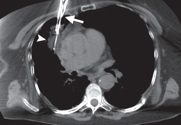 Figure 13b