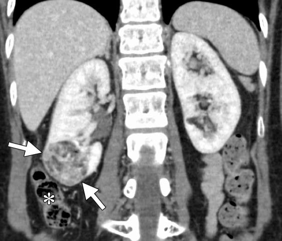 Figure 10a