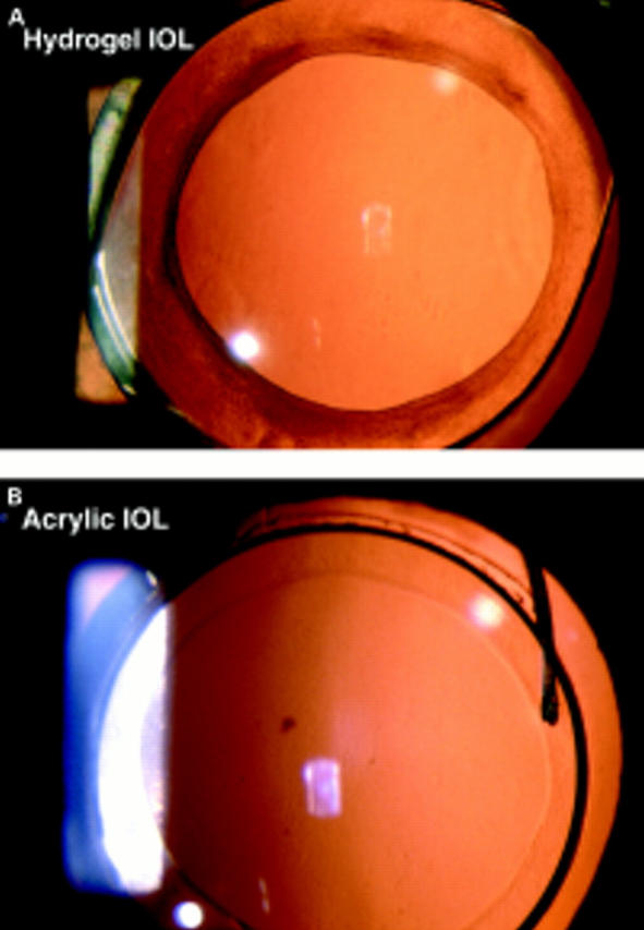 Figure 4  