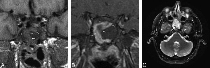 Fig 4.