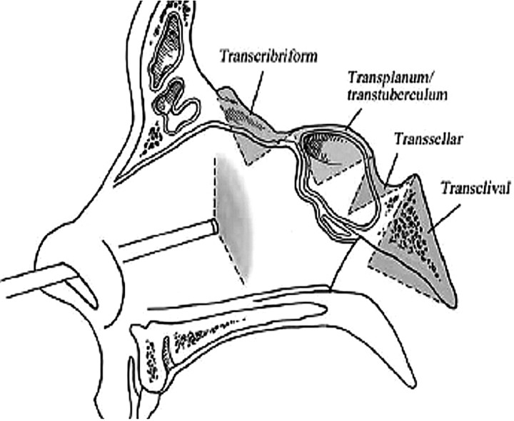 Fig 1.