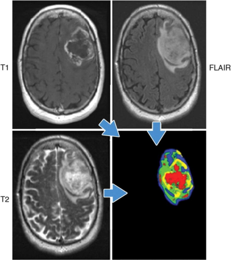 Unravelling tumour heterogeneity using next-generation imaging ...