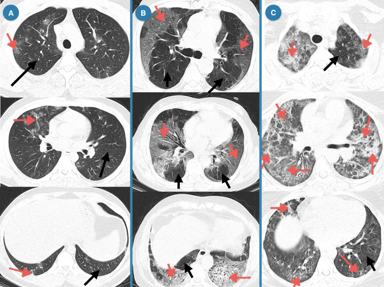 Figure 4