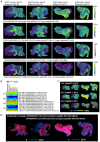 Figure 5. Variation in CRC pathology dependent on collagen peptide status of hydroxylated proline modification. (A) Case studies of example peptides identified by sequencing proteomics on the same tis...