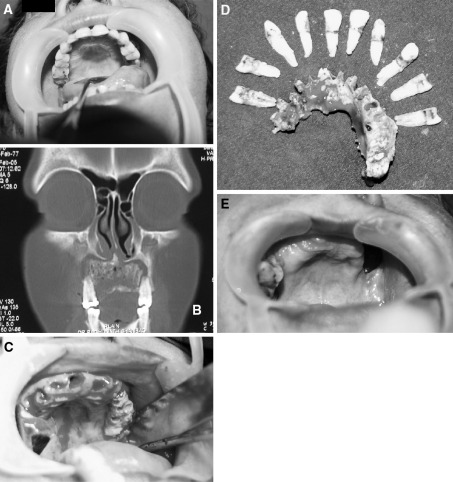 Fig. 2