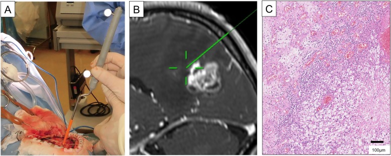 Fig. 1