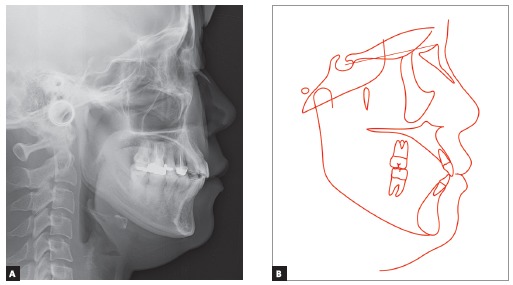 Figure 13