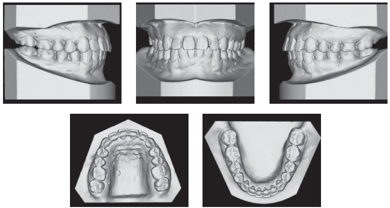 Figure 11