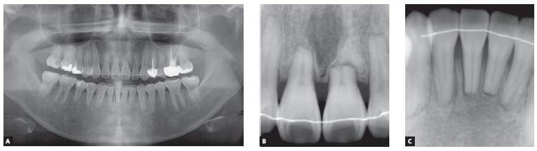 Figure 12