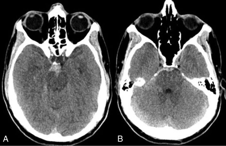 Fig 1.