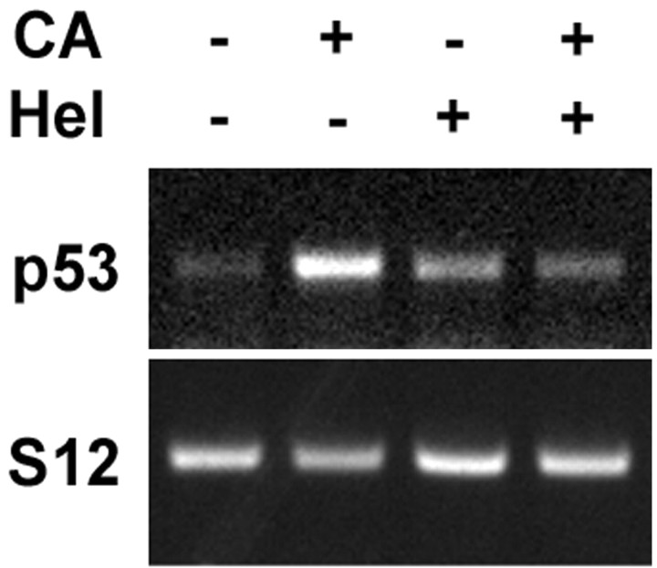 
Figure 11.
