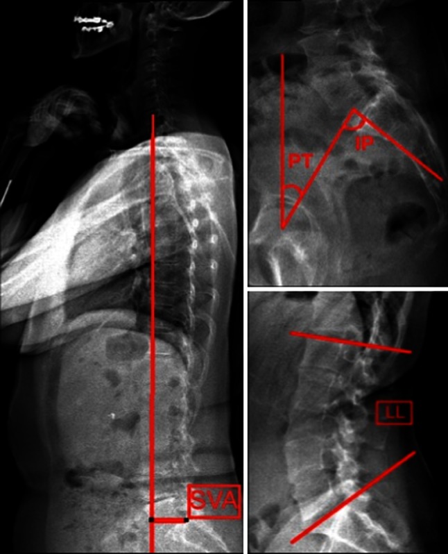 Fig. 1