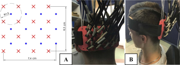 Fig. 1.