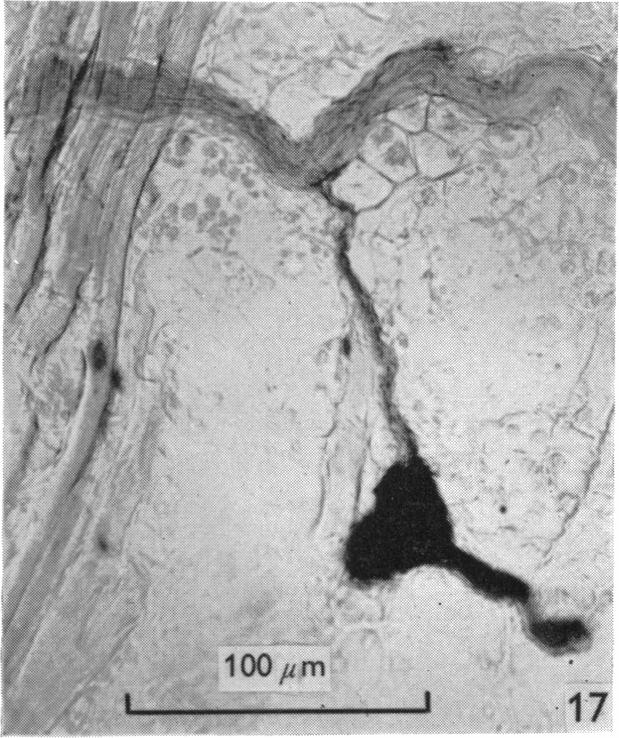 Fig. 17