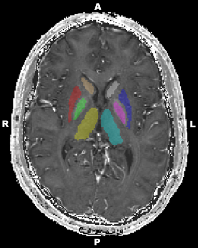 Fig.1