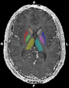 Fig.1