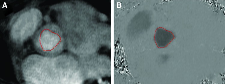 FIG. 3.