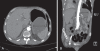 Figure 2)